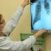 Brasil está na contramão da meta para erradicação da tuberculose